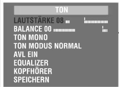 GRUNDIG Arcance 55 Flat MF 55-2401-5 TOP - Hinweis: - 1