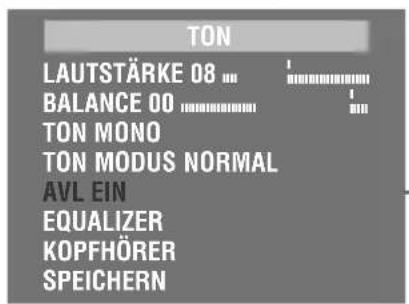 GRUNDIG Arcance 55 Flat MF 55-2401-5 TOP - Automatische Lautstärke - 1