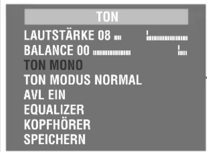 GRUNDIG Arcance 55 Flat MF 55-2401-5 TOP - Stereo-/Zweiton, Mono - 1