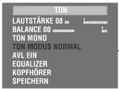 GRUNDIG Arcance 55 Flat MF 55-2401-5 TOP - Stereo-/Zweiton, Mono - 2
