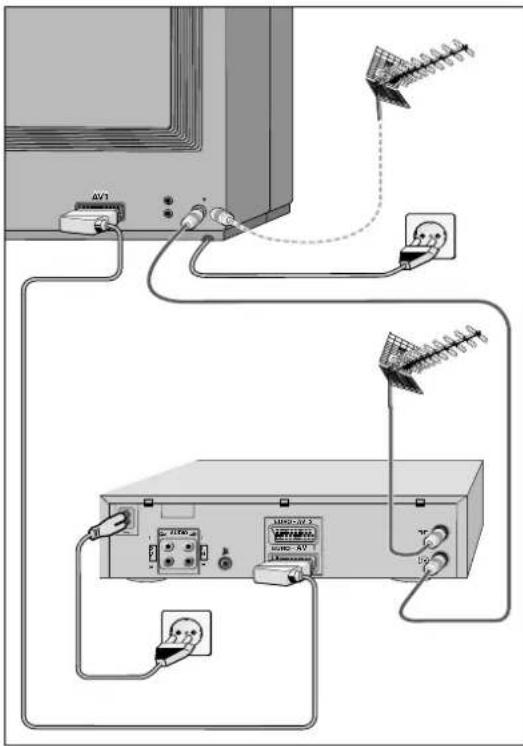 GRUNDIG M 84 211 8 IDTV - Anschlußbeispiel (Fernsehgerät und Video-Recorder) - 1