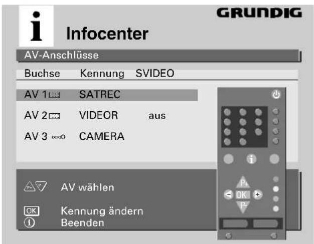 GRUNDIG M 72 105 IDTV - Vorgehensweise: - 1