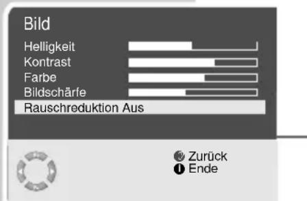 GRUNDIG Lenaro 72 FLAT MF 72 6510 8 IDTV - Bildmerkmale einstellen - 1
