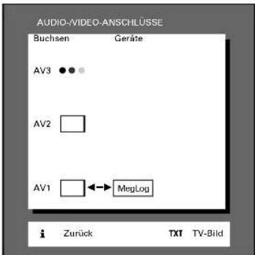 GRUNDIG Elegance m72 270 idtv log - 5 - 1