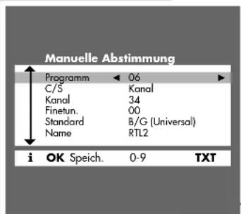GRUNDIG ST 70 5109 8 DOLBY - Hinweis: - 1
