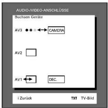 GRUNDIG ST 70 255 IDTV LOG - Decoder - 1