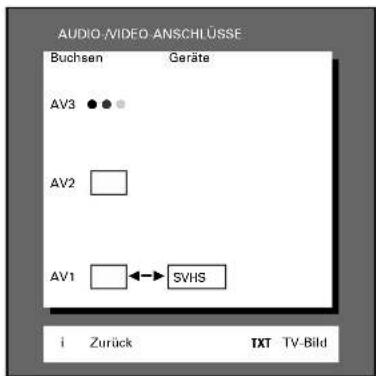 GRUNDIG ST 70 255 IDTV LOG - ... für S-VHS-Video-, S-VHS-Camera- oder Hi8-Camera-Recorder - 4