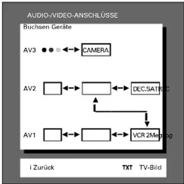 GRUNDIG ST 70 255 IDTV LOG - SAT-Receiver + Decoder für terrestrischen Empfang - 4