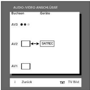 GRUNDIG ST 70 255 IDTV LOG - ... für Satelliten-Receiver - 4