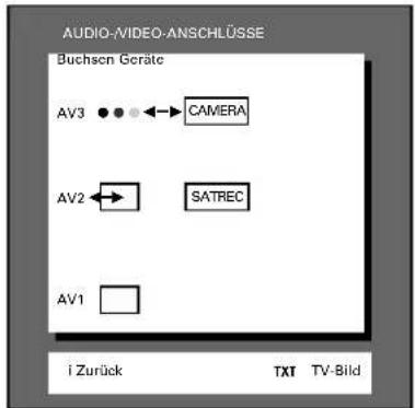 GRUNDIG ST 70 255 IDTV LOG - SAT-Receiver - 1