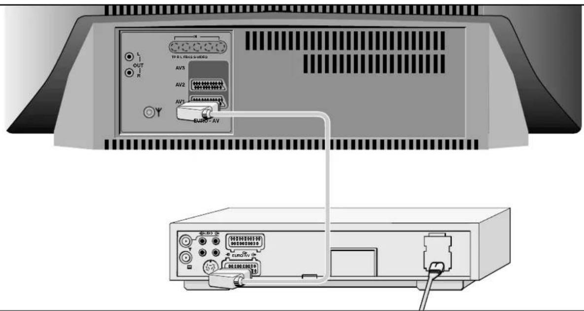 GRUNDIG ST 70 160 IDTV - Anschlußmöglichkeiten und Betrieb ... - 1