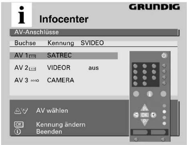 GRUNDIG ST 70 150 IDTV - Vorgehensweise: - 1