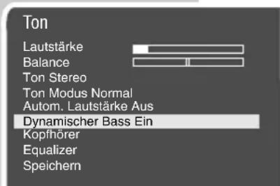 GRUNDIG MW70-2010 - Raumklang - 3