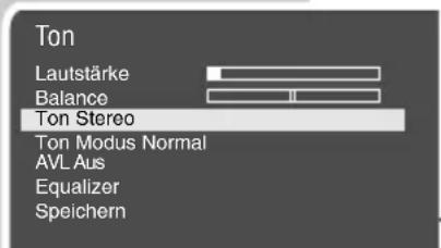 GRUNDIG MFS 554601 - Stereo-/Zweiton, Mono - 1