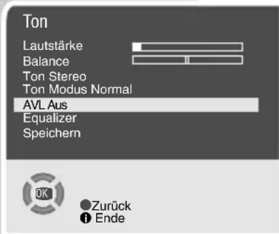 GRUNDIG Xentia 21 MFS 55-4701-8 TOP - Stereobreite - 1