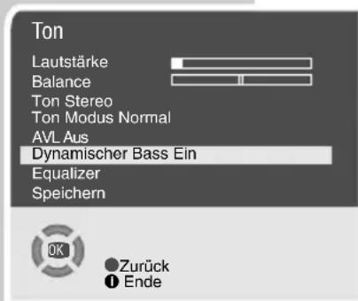 GRUNDIG ST70-7502 - Stereo-/Zweiton, Mono - 3