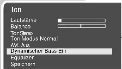 GRUNDIG ST70-5501 TOP LENARO 70 - Automatische Lautstärke - 1