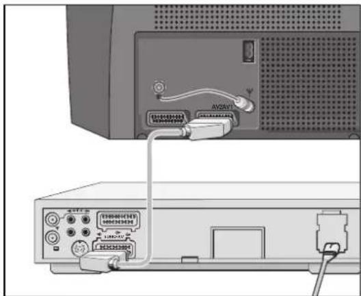 GRUNDIG ST70 850 - Videorecorder oder SET-TOP-Box an Buchse »AV 1« oder »AV 2« anschließen - 1