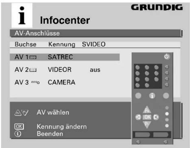 GRUNDIG ST 72 161 IDTV - Vorgehensweise: - 1