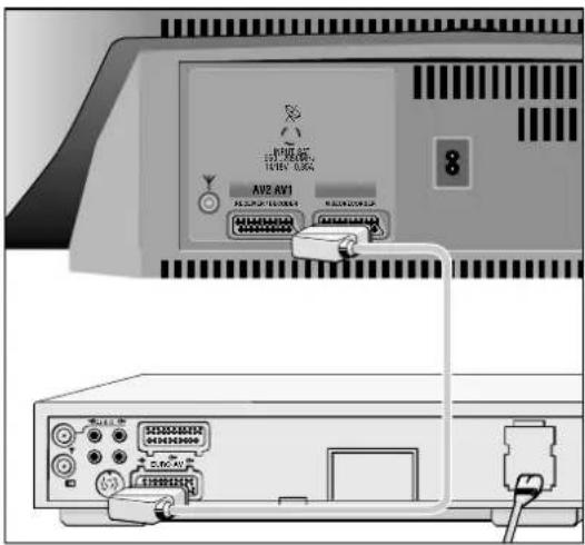 GRUNDIG ST 72 261 IDTV LOG - Anschließen - 1