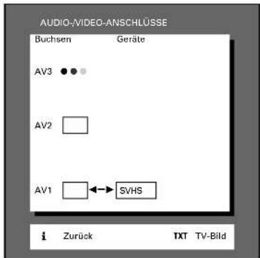 GRUNDIG ST 72 261 IDTV LOG - ... für S-VHS-Video-, S-VHS-Camera- oder Hi8-Camera-Recorder - 2