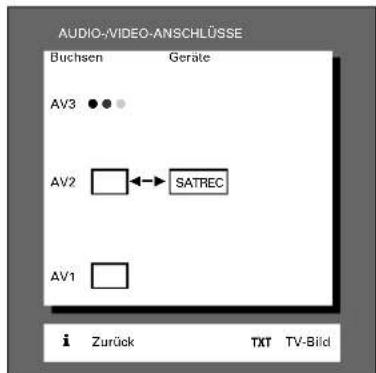 GRUNDIG ST 72 261 IDTV LOG - ... für Satelliten-Receiver - 2