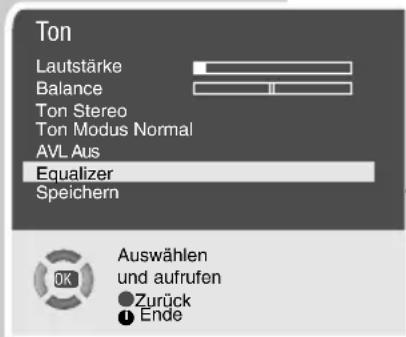GRUNDIG ST 70-2003 - Automatische Lautstärke - 1