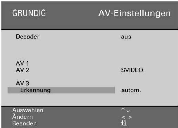 GRUNDIG ST 70 755 TOP LOG - Bedienen - 1