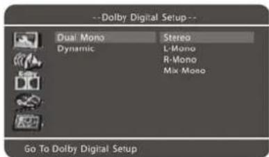 Soundmaster P250DVD - (1). DUAL MONO - 1