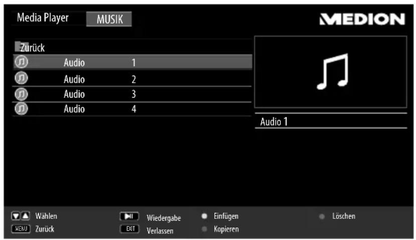 MEDION MD 30800 LIFE P15180 - Musik wiedergeben - 1
