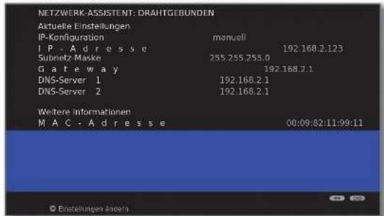 LOEWE ART 46 LED 200 - Konfiguration des eingebauten LAN-Adapters - 1