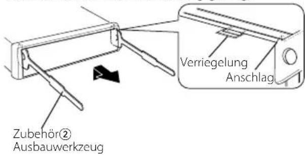 KENWOOD KDC-W7531 - Ausbau des Hartgummirahmens - 1
