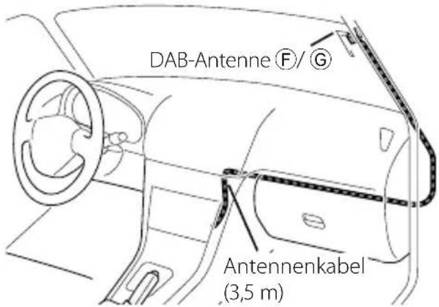 KENWOOD KDC-4551U - Ausbau des Geräts - 2