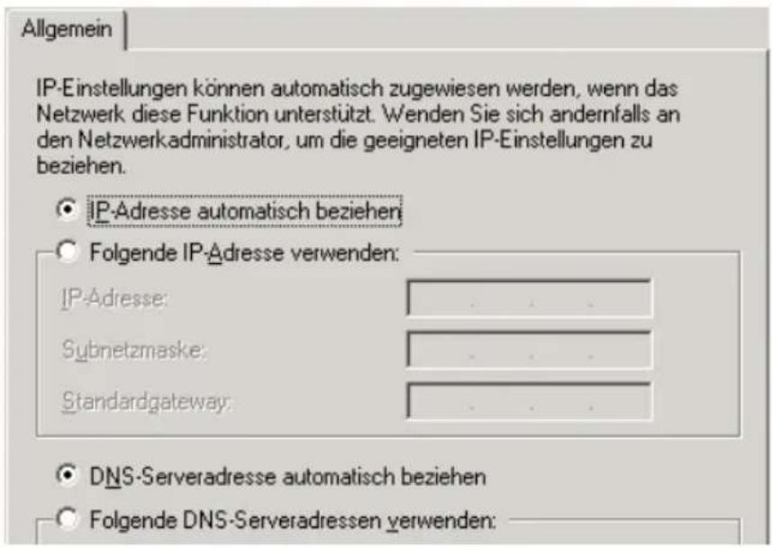 AVM Fritz!Box 7170 SL Fon WLAN - IP-Adresse automatisch beziehen in Windows 2000 - 2