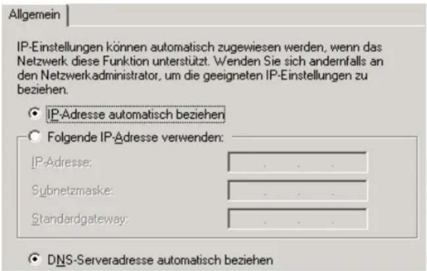 AVM Fritz!Box 3170 - IP-Adresse automatisch beziehen in Windows 2000 - 2