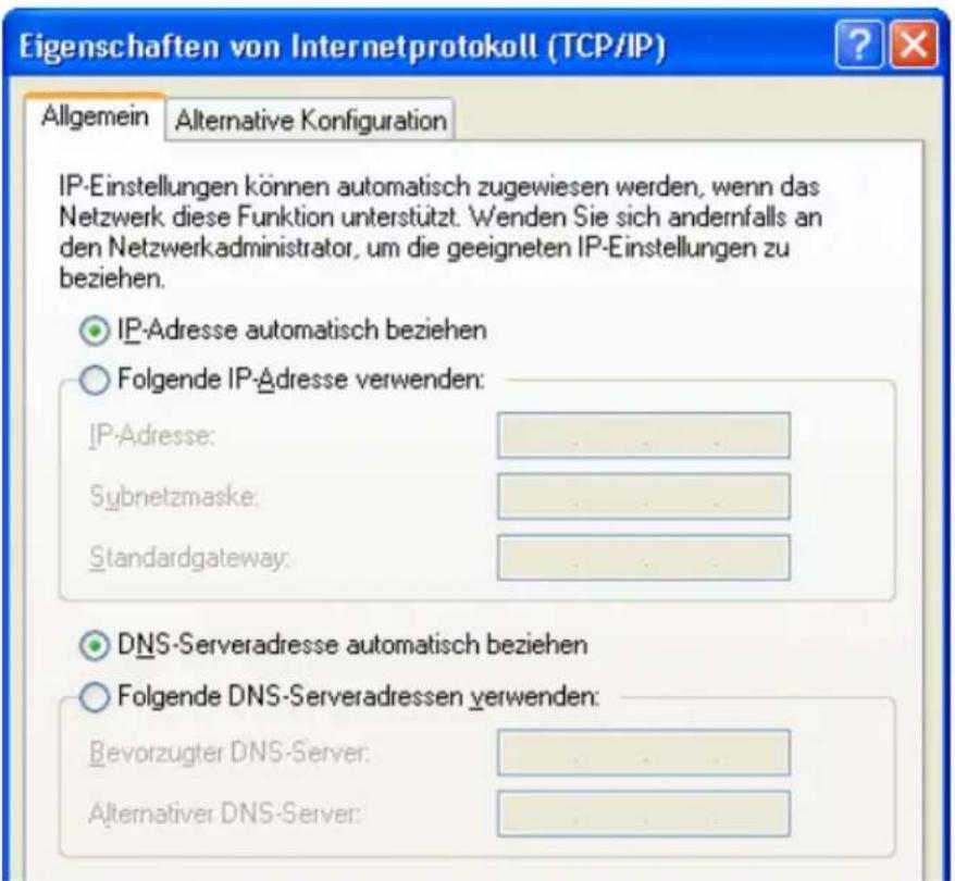 AVM Fritz!Box 3170 - IP-Adresse automatisch beziehen in Windows XP - 1