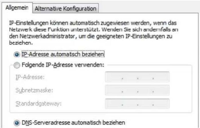 AVM Fritz!Box 3170 - IP-Adresse automatisch beziehen in Windows Vista - 1