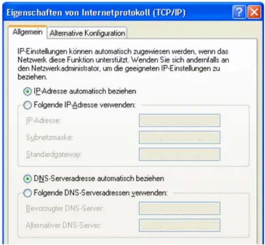 AVM Fritz!Box 3030 WLAN - IP-Adresse automatisch beziehen in Windows XP - 1