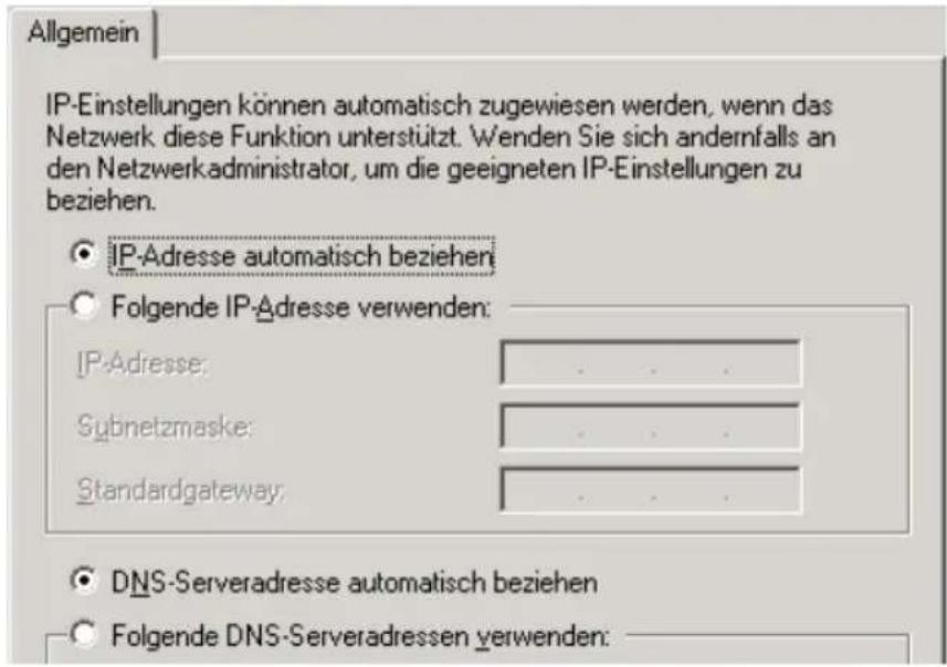 AVM Fritz!Box 3030 WLAN - IP-Adresse automatisch beziehen in Windows 2000 - 2