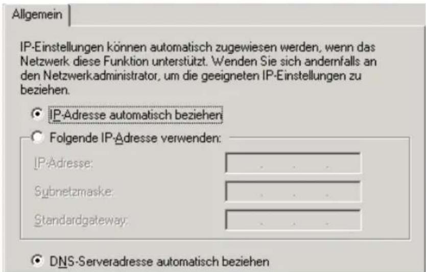 AVM Fritz!Box 3131 WLAN - IP-Adresse automatisch beziehen in Windows 2000 - 2