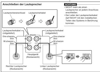 JVC NX-AK1 - Merkmale der Hauptfüße und Noppen - 3