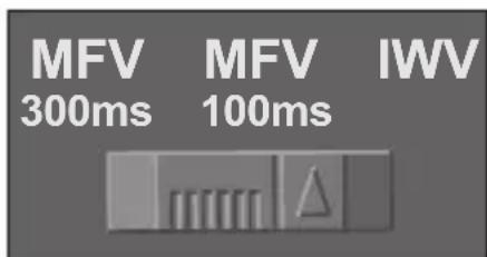 AUDIOLINE 927G - MFV/IWV WÄHLVERFAHREN/ T-NET ANPASSUNG - 1