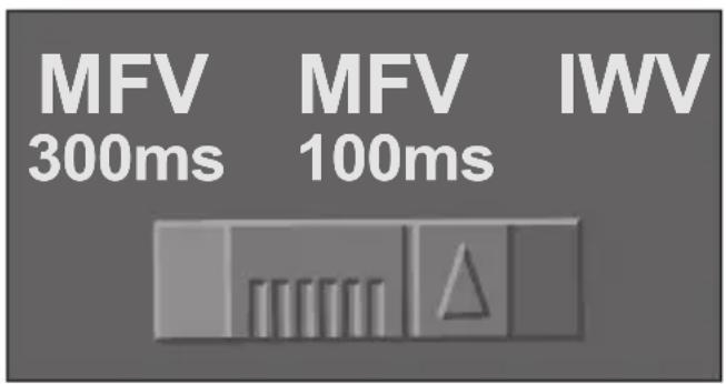 AUDIOLINE 937G - MFV/IWV WÄHLVERFAHREN/ T-NET ANPASSUNG - 1
