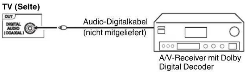 ORION TV24LB985DVD - Anschluß eines Digital-Verstärkers oder Digital-A/V-Receivers (mit DTS- oder Dolby Digital-Decoder) - 1