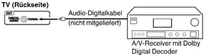 ORION TV22QBD945DVDS - Anschluß eines Digital-Verstärkers oder Digital-A/V-Receivers (mit DTS- oder Dolby Digital-Decoder) - 1