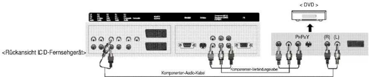 DVD. Komponenten-Audio-Kabel. Komponenten-Verbindungskabel. Pr-Pb-Y. (R)(L).
