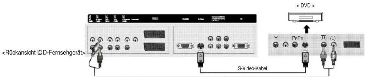 S-Video-Kabel. DVD. Y, Pb, Pr. (R)(L).