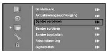 ORION TV32PL178DVD - Autom. Senderspeicherung für analog. KabelTV - 9
