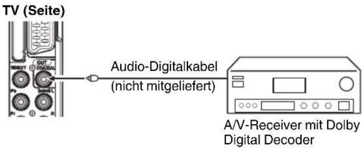 ORION TV26PLW7905DVD - Anschluß eines Digital-Verstärkers oder Digital-A/V-Receivers (mit DTS- oder Dolby Digital-Decoder) - 1