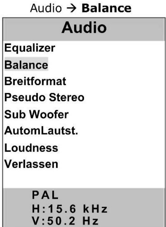 MEDION MD7223 - Equalizer - 3